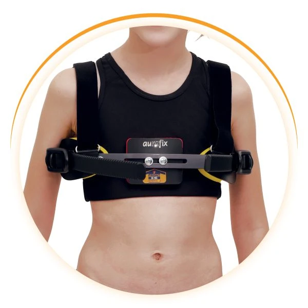 Pectus Carinatum Orthosis – Adjustable Chest Brace for Pigeon Chest Deformity